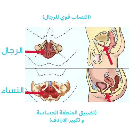 جهاز تقوية عضلات قاع الحوض